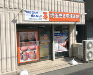 求人募集中の浦和の巻き爪専門院
